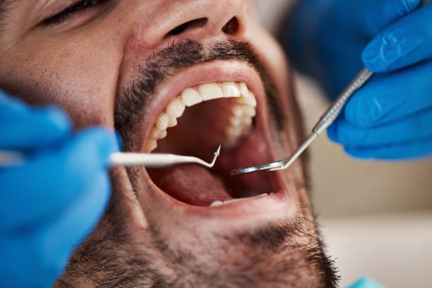 Best Emergency TMJ Treatment in Fredonia, NY